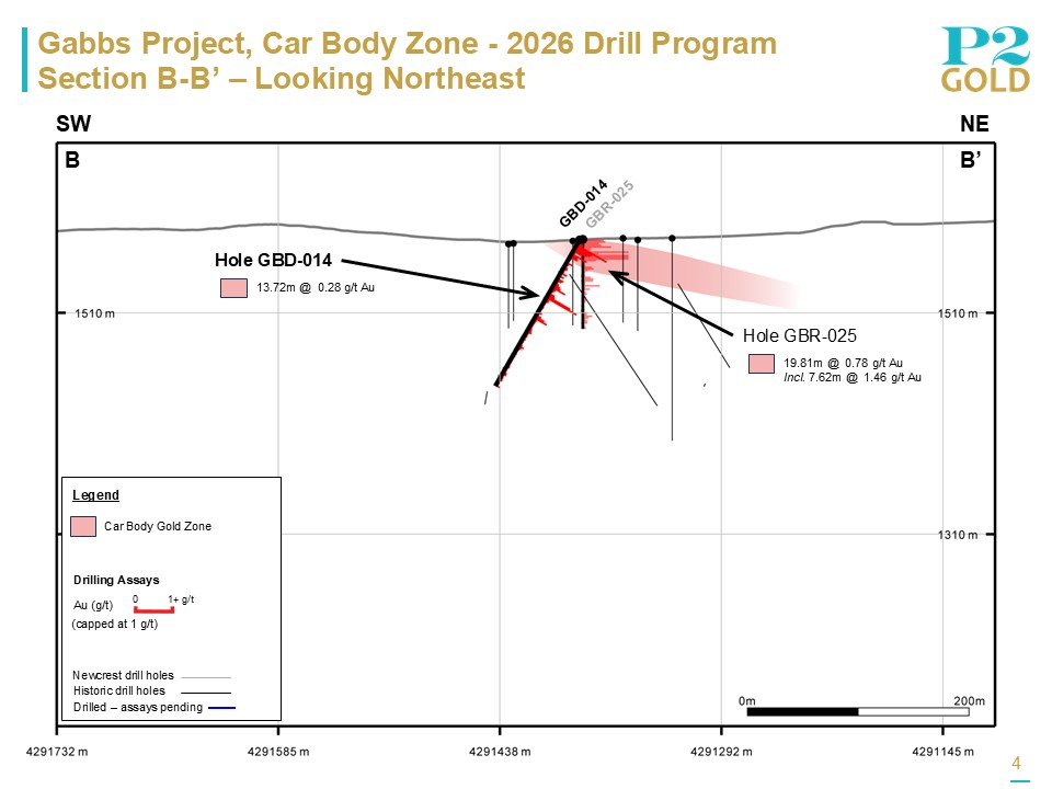 Car Body Zone